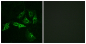Immunofluorescence of A549 cells, using GNRHR Antibody. The picture on the right is treated with the synthesized peptide.