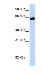 GHR / Growth Hormone Receptor antibody LS-C110871 Western blot of Fetal Muscle lysate.