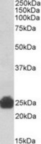 Gsta5 antibody (0.3 ug/ml) staining of Rat Liver lysate (35 ug protein/ml in RIPA buffer). Primary incubation was 1 hour. Detected by chemiluminescence.