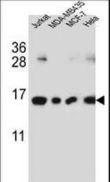 H2AFJ Antibody western blot of Jurkat,MDA-MB435,MCF-7,HeLa cell line lysates (35 ug/lane). The H2AFJ antibody detected the H2AFJ protein (arrow).