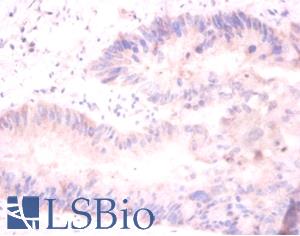 Immunohistochemistry of paraffin-embedded mouse liver using H2AFJ antibody at dilution of 1:100.