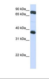 Jurkat cell lysate. Antibody concentration: 1.0 ug/ml. Gel concentration: 12%.