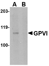 Western blot of GPVI in mouse brain lysate with GPVI antibody at 1 ug/ml in either the absence or (B) the presence of blocking peptide.
