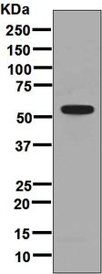 Western blot analysis on human platelet lysate using anti-GP6 / GPVI antibody.