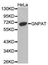 Western blot analysis of extracts of HeLa cell line, using GNPAT antibody.