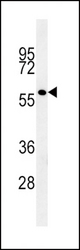GP6 Antibody western blot of K562 cell line lysates (15 ug/lane). The GP6 antibody detected the GP6 protein (arrow).