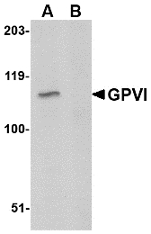 Western blot of GPVI in A20 lysate with GPVI antibody at 1 ug/m in either the absence or (B) the presence of blocking peptide.