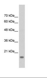 HepG2 Cell Lysate