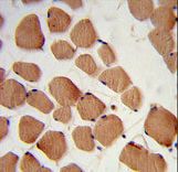 Formalin-fixed and paraffin-embedded human skeletal muscle reacted with PHYH2 Antibody , which was peroxidase-conjugated to the secondary antibody, followed by DAB staining. This data demonstrates the use of this antibody for immunohistochemistry; clinical relevance has not been evaluated.