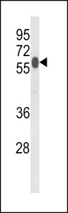 Western blot of PHYH2 Antibody in mouse liver tissue lysates (35 ug/lane). PHYH2 (arrow) was detected using the purified antibody.