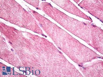 Anti-HACL1 antibody IHC of human skeletal muscle. Immunohistochemistry of formalin-fixed, paraffin-embedded tissue after heat-induced antigen retrieval. Antibody LS-B7925 dilution 5 ug/ml.