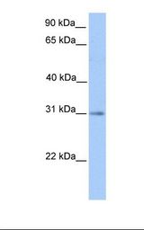 Fetal liver lysate. Antibody concentration: 1.0 ug/ml. Gel concentration: 12%.
