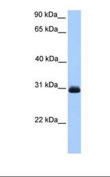 Fetal liver lysate. Antibody concentration: 1.0 ug/ml. Gel concentration: 12%.