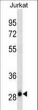 HAGH Antibody (Ascites)western blot of Jurkat cell line lysates (35 ug/lane). The HAGH antibody detected the HAGH protein (arrow).