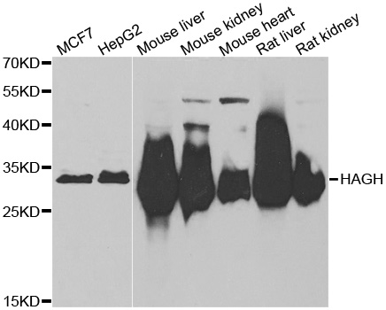 Western blot analysis of extracts of various cell lines, using HAGH antibody.