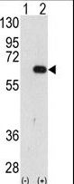 Western blot of AMFR (arrow) using AMFR Antibody. 293 cell lysates (2 ug/lane) either nontransfected (Lane 1) or transiently transfected with the AMFR gene (Lane 2) (Origene Technologies).