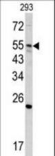 Western blot of GNS antibody (Center N189) in 293 cell line lysates (35 ug/lane). GNS (arrow) was detected using the purified antibody.