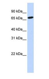 HAL / Histidine Ammonium Lyase antibody Western Blot of 721_B cell lysate.