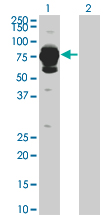 Western Blot analysis of HAL expression in transfected 293T cell line by HAL monoclonal antibody (M04), clone 4F2.Lane 1: HAL transfected lysate(72.698 KDa).Lane 2: Non-transfected lysate.