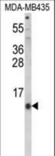 Western blot of HAMP Antibody in MDA-MB435 cell line lysates (35 ug/lane). HAMP (arrow) was detected using the purified antibody.