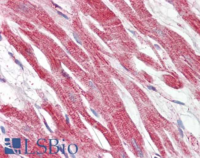 Anti-HAMP / Hepcidin antibody IHC of human heart. Immunohistochemistry of formalin-fixed, paraffin-embedded tissue after heat-induced antigen retrieval. Antibody LS-B7371 concentration 3.75 ug/ml.