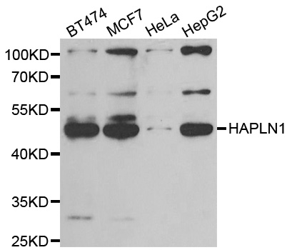 Western blot analysis of extracts of various cell lines, using HAPLN1 antibody.