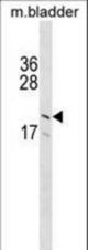 GP9 Antibody western blot of mouse bladder tissue lysates (35 ug/lane). The GP9 antibody detected the GP9 protein (arrow).