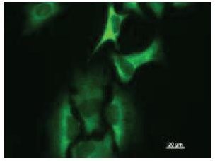 Immunofluorescent staining using HARS antibody. Immunostaining analysis in HeLa cells. HeLa cells were fixed with 4% paraformaldehyde and permeabilized with 0.01% Triton-X100 in PBS. The cells were immunostained with anti-HARS antibody.