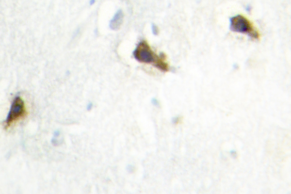 IHC of HisRS (E492) pAb in paraffin-embedded human brain tissue.