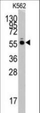 Western blot of anti-HARS antibody in K562 cell line lysates (35 ug/lane). HARS (arrow) was detected using the purified antibody.