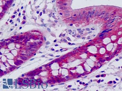 Human, Small intestine: Formalin-Fixed Paraffin-Embedded (FFPE)