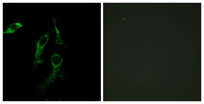 Immunofluorescence of HepG2/HeLa cells, using HARS Antibody. The picture on the right is treated with the synthesized peptide.