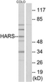 Western blot of extracts from COLO cells, using HARS Antibody. The lane on the right is treated with the synthesized peptide.