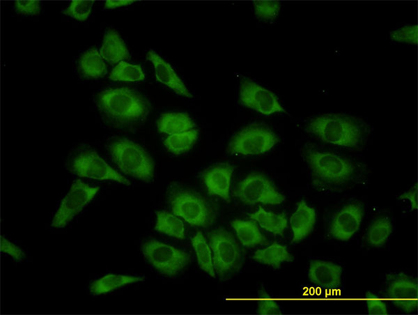 Immunofluorescence of monoclonal antibody to HARS on HeLa cell. [antibody concentration 10 ug/ml]