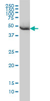 HARS monoclonal antibody (M01), clone 1C8 Western Blot analysis of HARS expression in HeLa.