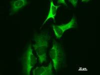 Immunostaining analysis in HeLa cells. HeLa cells were fixed with 4% paraformaldehyde and permeabilized with 0.1% Triton X-100 in PBS. The cells were immunostained with anti-HARS mAb.