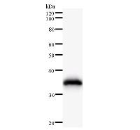 Western blot analysis of immunized recombinant protein, using anti-HARS monoclonal antibody.