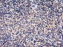 IHC of paraffin-embedded Human lymphoma tissue using anti-HARS2 mouse monoclonal antibody.