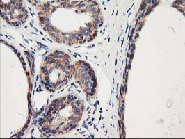 IHC of paraffin-embedded Human breast tissue using anti-HARS2 mouse monoclonal antibody.