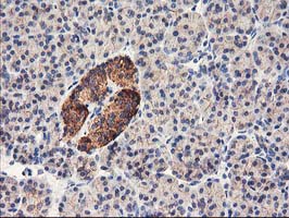 IHC of paraffin-embedded Human pancreas tissue using anti-HARS2 mouse monoclonal antibody.