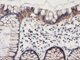 IHC of paraffin-embedded Human colon tissue using anti-HARS2 mouse monoclonal antibody.