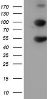 HEK293T cells were transfected with the pCMV6-ENTRY control (Left lane) or pCMV6-ENTRY HARS2 (Right lane) cDNA for 48 hrs and lysed. Equivalent amounts of cell lysates (5 ug per lane) were separated by SDS-PAGE and immunoblotted with anti-HARS2.