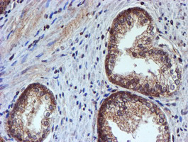 IHC of paraffin-embedded Human prostate tissue using anti-HARS2 mouse monoclonal antibody.
