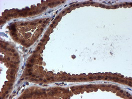 IHC of paraffin-embedded Human breast tissue using anti-HARS2 mouse monoclonal antibody.
