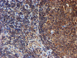 IHC of paraffin-embedded Human tonsil using anti-HARS2 mouse monoclonal antibody.