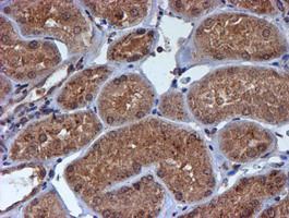 IHC of paraffin-embedded Human Kidney tissue using anti-HARS2 mouse monoclonal antibody.