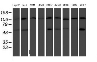 Western blot of extracts (35 ug) from 9 different cell lines by using anti-HARS2 monoclonal antibody.