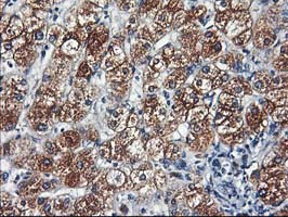 IHC of paraffin-embedded Human liver tissue using anti-HARS2 mouse monoclonal antibody.