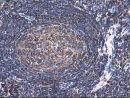 IHC of paraffin-embedded Human tonsil using anti-HARS2 mouse monoclonal antibody.