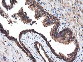 IHC of paraffin-embedded Human prostate tissue using anti-HARS2 mouse monoclonal antibody.